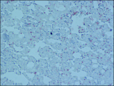 Anti-MR−Pro ADM (Internal) antibody produced in rabbit affinity isolated antibody