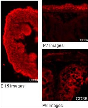 Anti-CD36 affinity isolated antibody