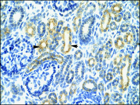 Anti-IRF8 antibody produced in rabbit affinity isolated antibody