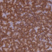 Anti-RPL8 antibody produced in rabbit Prestige Antibodies® Powered by Atlas Antibodies, affinity isolated antibody, buffered aqueous glycerol solution
