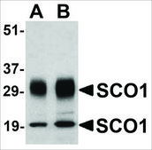 Anti-SCO1 antibody produced in rabbit affinity isolated antibody, buffered aqueous solution