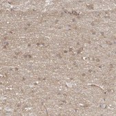 Anti-MTERF4 antibody produced in rabbit Prestige Antibodies® Powered by Atlas Antibodies, affinity isolated antibody, buffered aqueous glycerol solution