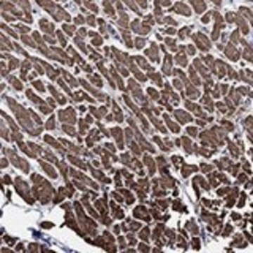 Anti-NDUFAB1 antibody produced in rabbit Prestige Antibodies&#174; Powered by Atlas Antibodies, affinity isolated antibody, buffered aqueous glycerol solution