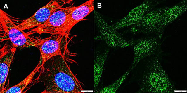 Anti-FKHR/FOXO1 Antibody, clone 1D21 ZooMAb&#174; Rabbit Monoclonal recombinant, expressed in HEK 293 cells