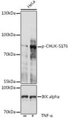 Anti-Phospho-CHUK-S176 antibody produced in rabbit