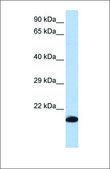 Anti-GPX4 antibody produced in rabbit affinity isolated antibody