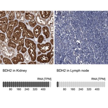 Anti-BDH2 antibody produced in rabbit Prestige Antibodies&#174; Powered by Atlas Antibodies, affinity isolated antibody, buffered aqueous glycerol solution