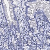 Anti-CALCA antibody produced in rabbit Prestige Antibodies® Powered by Atlas Antibodies, affinity isolated antibody, buffered aqueous glycerol solution