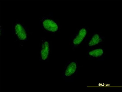 Anti-ZFP28 antibody produced in mouse purified immunoglobulin, buffered aqueous solution