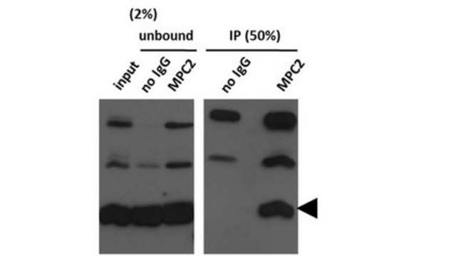 Anti-Mitochondrial Pyruvate Carrier 2 (BRP44) clone n/a, from mouse