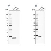 Anti-LGALS1 Prestige Antibodies® Powered by Atlas Antibodies, affinity isolated antibody, buffered aqueous glycerol solution
