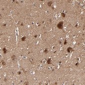 Anti-BDKRB1 antibody produced in rabbit Prestige Antibodies® Powered by Atlas Antibodies, affinity isolated antibody, buffered aqueous glycerol solution