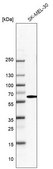 Anti-SARS antibody produced in rabbit Prestige Antibodies® Powered by Atlas Antibodies, affinity isolated antibody, buffered aqueous glycerol solution