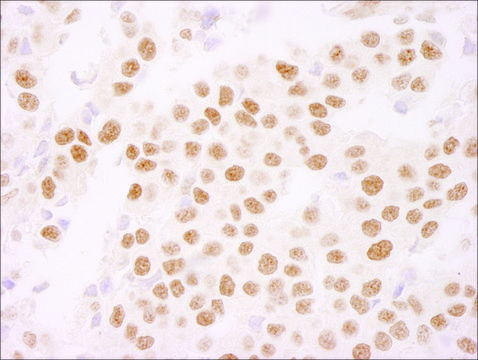 Rabbit anti-Ki-67 IHC Antibody, Affinity Purified Powered by Bethyl Laboratories, Inc.