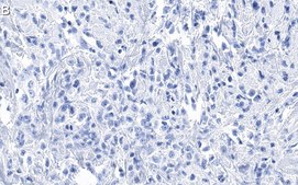Anti-Cdk4 Antibody, clone 1E19 ZooMAb® Rabbit Monoclonal recombinant, expressed in HEK 293 cells