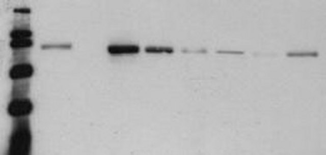 Anti-&#946;-Catenin, Dephospho Mouse mAb (8E4) lyophilized, clone 8E4, Calbiochem&#174;