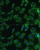 Anti-LGALS3 antibody produced in rabbit