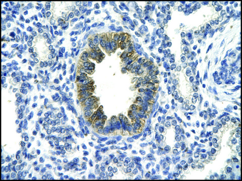 Anti-TP53 antibody produced in rabbit IgG fraction of antiserum