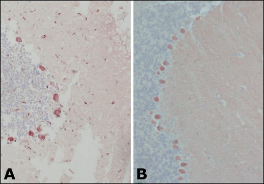 Anti-Calbindin-D-28K (EG-20) antibody produced in rabbit affinity isolated antibody, buffered aqueous solution