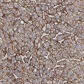 Anti-GLT8D2 antibody produced in rabbit Prestige Antibodies® Powered by Atlas Antibodies, affinity isolated antibody, buffered aqueous glycerol solution