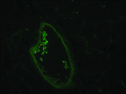 Monoclonal Anti-Actin, Smooth Muscle antibody produced in mouse ~1.0&#160;mg/mL, clone CGA7, purified immunoglobulin, buffered aqueous solution