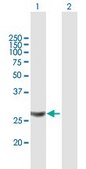 Anti-MRPL28 antibody produced in mouse purified immunoglobulin, buffered aqueous solution