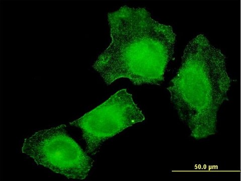 Monoclonal Anti-TIAM2 antibody produced in mouse clone 3C1, purified immunoglobulin, buffered aqueous solution