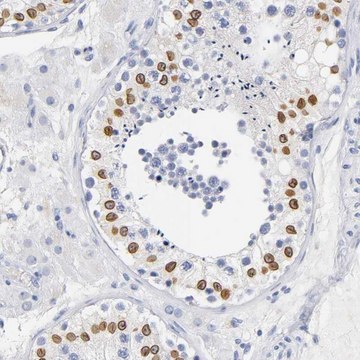 Anti-SOCS7 antibody produced in rabbit Prestige Antibodies&#174; Powered by Atlas Antibodies, affinity isolated antibody, buffered aqueous glycerol solution