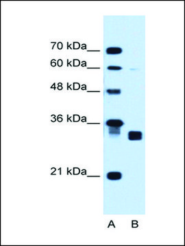 Anti-CBR1 antibody produced in rabbit IgG fraction of antiserum