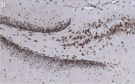 Anti-AFF2 Antibody, clone 1G13 ZooMAb® Rabbit Monoclonal recombinant, expressed in HEK 293 cells