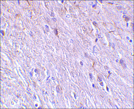 Anti-TTC5 antibody produced in rabbit affinity isolated antibody, buffered aqueous solution