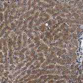 Anti-ERGIC1 antibody produced in rabbit Prestige Antibodies® Powered by Atlas Antibodies, affinity isolated antibody, buffered aqueous glycerol solution, Ab1