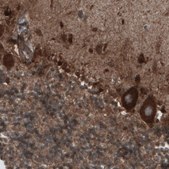 Monoclonal Anti-CARS antibody produced in mouse Prestige Antibodies® Powered by Atlas Antibodies, clone CL2302, purified immunoglobulin, buffered aqueous glycerol solution