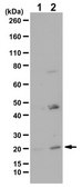 Anti-phospho BAD Antibody (Ser155) from rabbit, purified by affinity chromatography