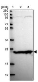 Anti-TPRG1 antibody produced in rabbit Prestige Antibodies® Powered by Atlas Antibodies, affinity isolated antibody, buffered aqueous glycerol solution