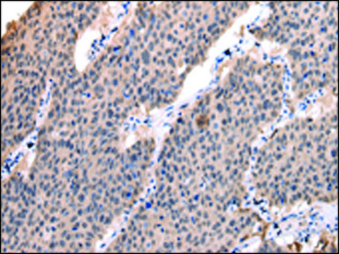 Anti-POLR2K affinity isolated antibody