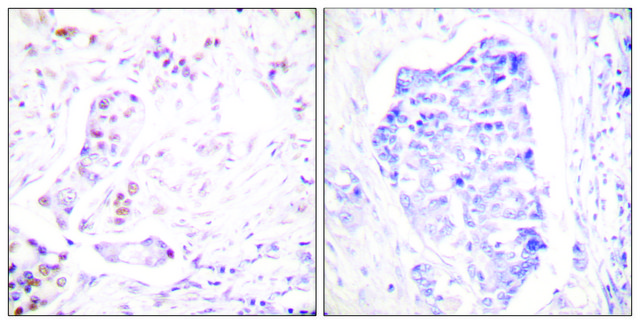 Anti-Cyclin A1 antibody produced in rabbit affinity isolated antibody