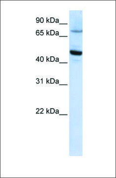 Anti-CYP46A1 antibody produced in rabbit affinity isolated antibody