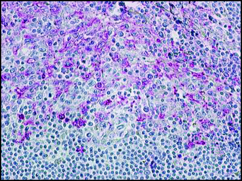 Anti-CCR8 antibody produced in rabbit affinity isolated antibody, buffered aqueous solution