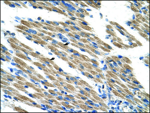 Anti-KEAP1 (AB2) antibody produced in rabbit affinity isolated antibody