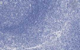 Anti-Clusterin Antibody, clone 2F23 ZooMAb® Rabbit Monoclonal recombinant, expressed in HEK 293 cells