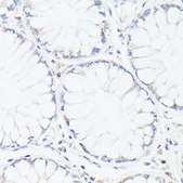 Anti-p53 antibody produced in rabbit