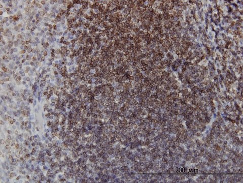 ANTI-EPHB3 antibody produced in mouse clone 2G9, purified immunoglobulin, buffered aqueous solution