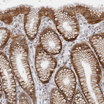 Anti-GGT6 antibody produced in rabbit Prestige Antibodies&#174; Powered by Atlas Antibodies, affinity isolated antibody, buffered aqueous glycerol solution