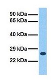 Anti-SCN3B affinity isolated antibody