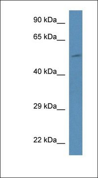 Anti-PI4K2B antibody produced in rabbit affinity isolated antibody