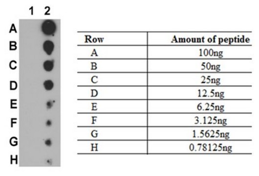 Anti-phospho-NF-kB (p100) (Ser707) Antibody from rabbit, purified by affinity chromatography