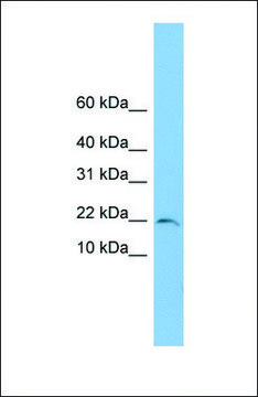 Anti-TRAPPC1 antibody produced in rabbit affinity isolated antibody