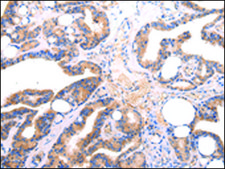 Anti-Lambda Light chain affinity isolated antibody