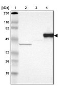 Anti-SERPINA7 antibody produced in rabbit Prestige Antibodies® Powered by Atlas Antibodies, affinity isolated antibody, buffered aqueous glycerol solution